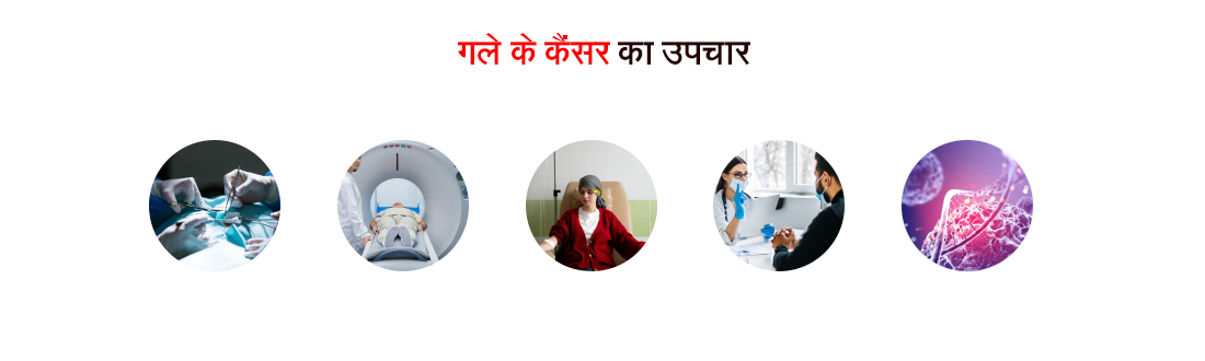 throat cancer treatment in hindi